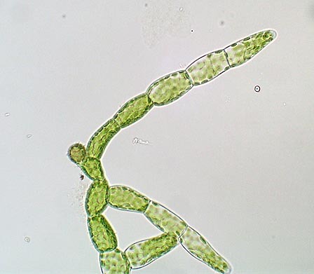 propaedeuticist:  protonemata>plant>sporangium: porn pictures