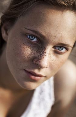 wicked-good:  Wicked-Good Freckles