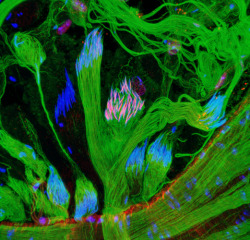 biocanvas:  Slowed by SUMO: Sperm from Drosophila melanogaster Fertilization of an egg by sperm seems just about impossible from a sperm’s perspective. There are chemical, mechanical, and physical obstacles that try to ensure only one sperm can fertilize