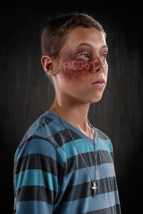 tonytobar:What if verbal abuse left the same scars as physical abuse? Would it be taken more serious