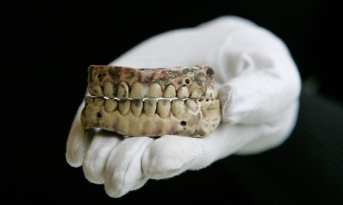 sixpenceee:Before the mid-19th century dentures were commonly made with teeth pulled from the mouths
