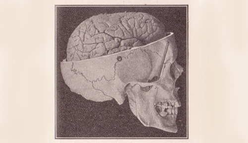 theatlantic:How to Build a Happier BrainThere is a motif, in fiction and in life, of people having w