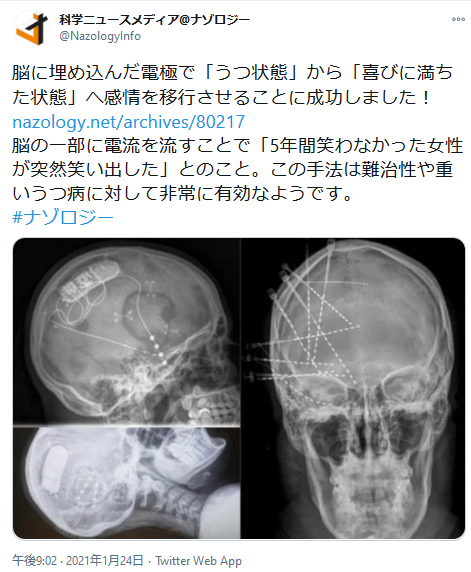 highlandvalley:  https://twitter.com/NazologyInfo/status/1353312090329673800ブラック･ジャック 快楽の座【単行本未収録＆唯一の完全封印作品】https://premium-goma.com/blackjack-kairakunoza/