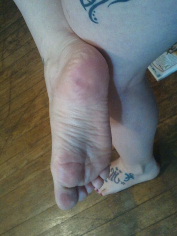 teenfeetlove:  Barb