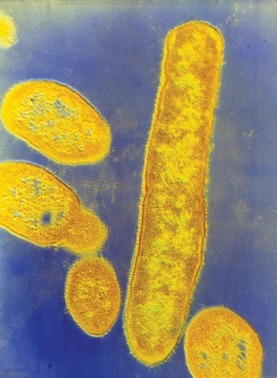 currentsinbiology:  Gut Bacteria May Play a Role in Autism (Scientific American)  Autism is primaril