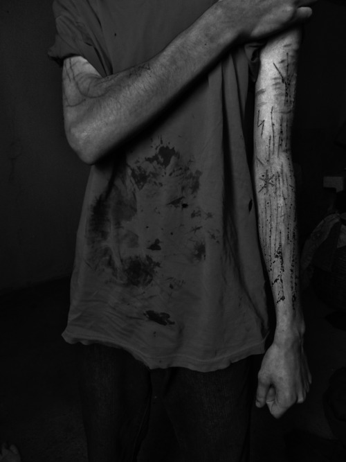 humandisasterss:  Photo session with my boyfriend 