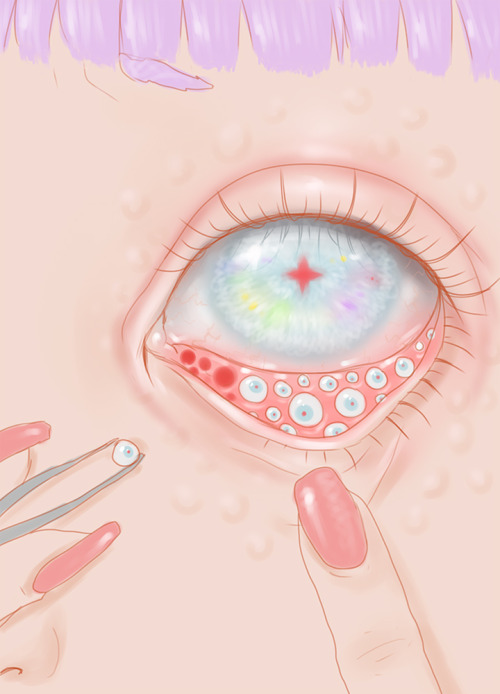 saccstry:  Day 20: EyesGemma’s got a bad case of eyeballitis hehe