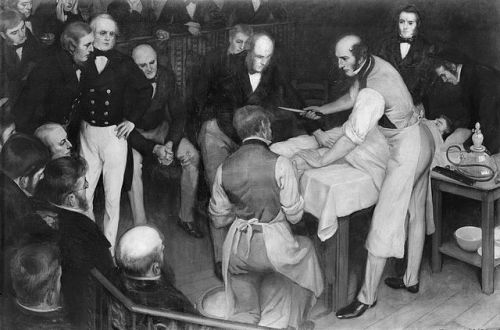 gwenynentantivy:  dangerhamster:  bundyspooks:  In the late 19th century, an inexperienced doctor performed his first surgery n a room full of people. Feeling the pressure, he felt the need to perform the amputation in the quickest time possible, and