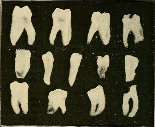 imensofarol: The Röntgen rays in medical work (1907) - Walsh, David.