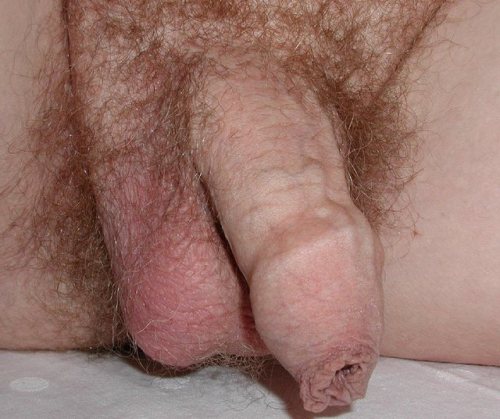 Porn Long Foreskin photos