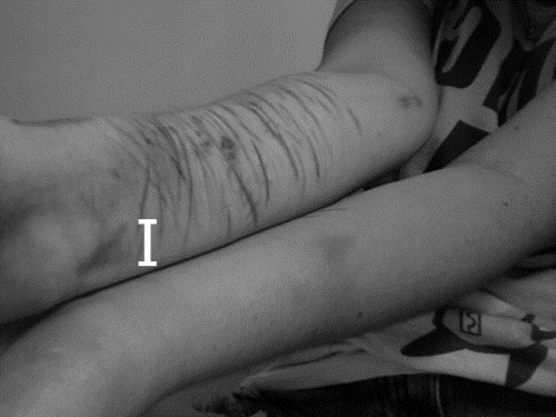 Un- suicidio-silencioso