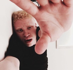 invisiblemelanin:  Black people with albinism are strong and beautiful, don’t deny our heritage. 