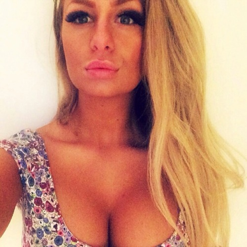 amateur-implant-pics:  @jellydevote what a great transformation