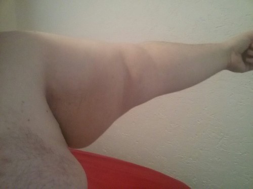 My arms and legs …