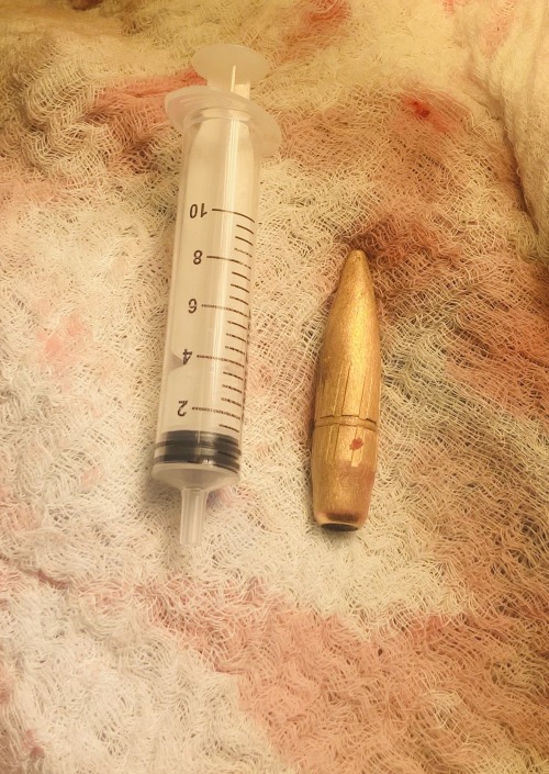 Very Urgent , Reblog Please This Is The Size Of A Quadcopter Bullet That We Extracted From An Injured