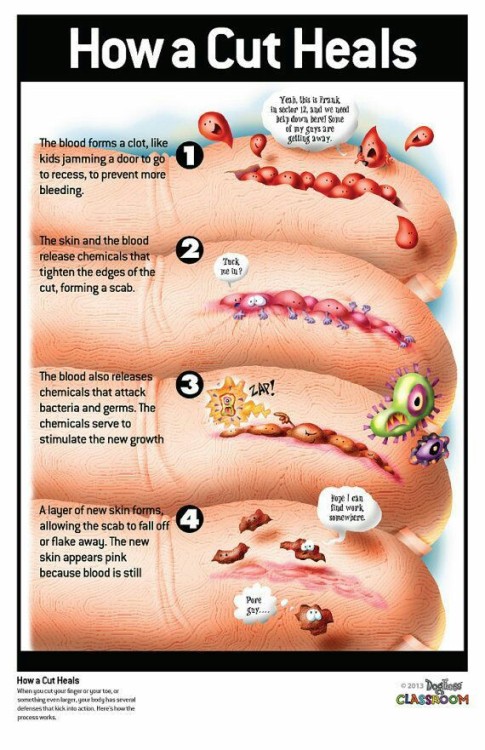 A neat infographic that explains how a cut heals.