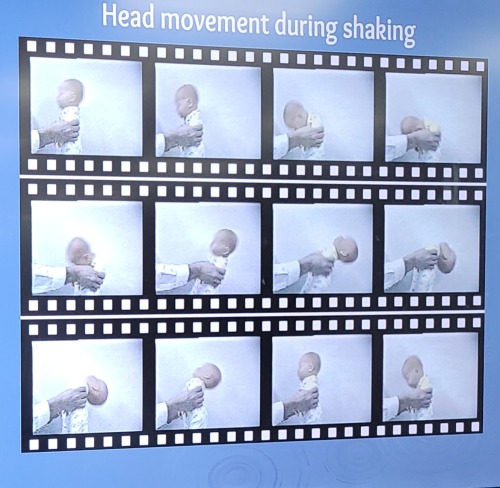 This Is What Happens When You Shake A Baby 