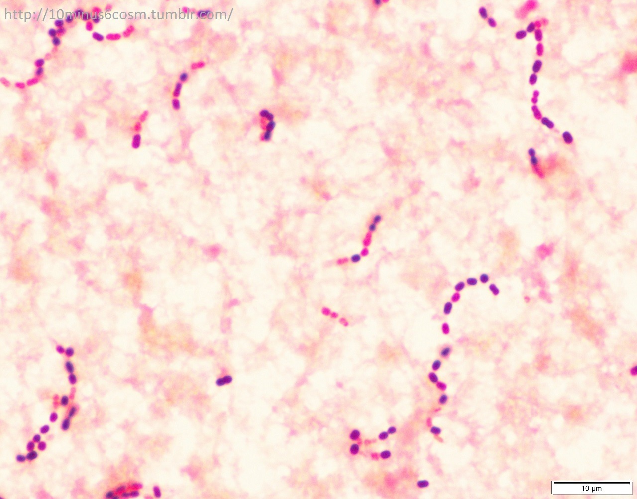 Gram Negative Cocci In Clusters