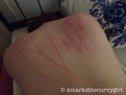 xmarksthecurvygirl:  Scratched