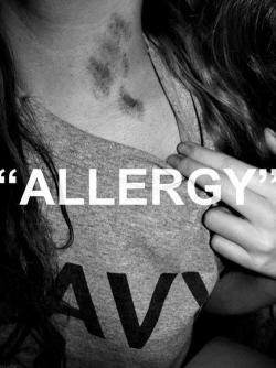 vocidiunamentecontorta9:  La chiamiamo “Allergia” quel piccolo segno, che, dopo una dolorosa ma stupenda emozione, ci spunta sul collo. Come un livido! Che purtroppo prima o poi andrà via, portando con se chi lo crea.