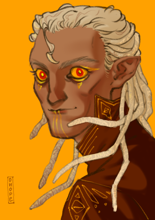 He Is Going To Kill Somebody NOW (probably Himself)yes, This Is Golden Eyeliner Over The Bruises Under