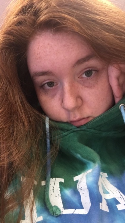 lilspicywitch: I’d be a different person if I wasn’t a ginger Feine Sommersprossen