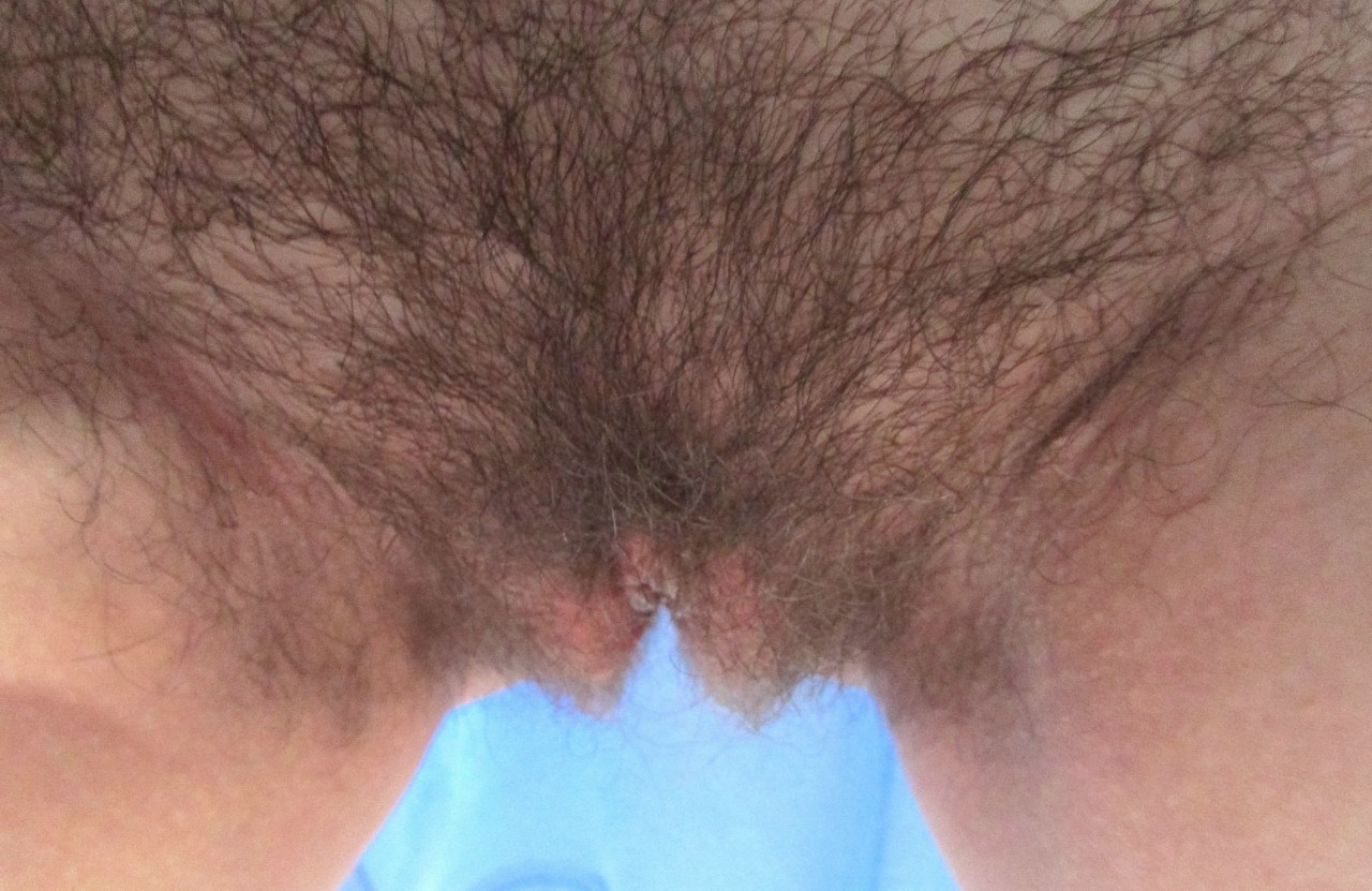 largelabiaproject:  Email Submission: “I’m 19 years old, and I am so glad that