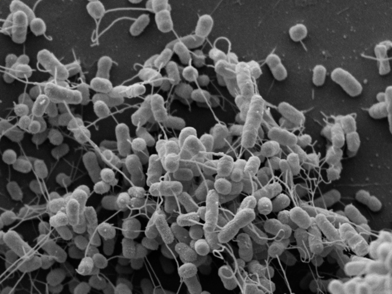 currentsinbiology:Bacteria connect to each other and exchange nutrients					It is