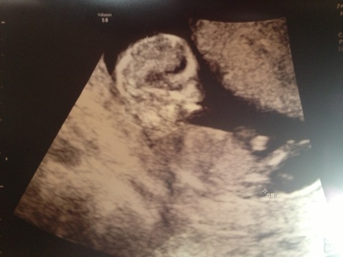 Our little BabyB ultrasound, Due January 30th 2014, BabyB can’t wait to meet you!