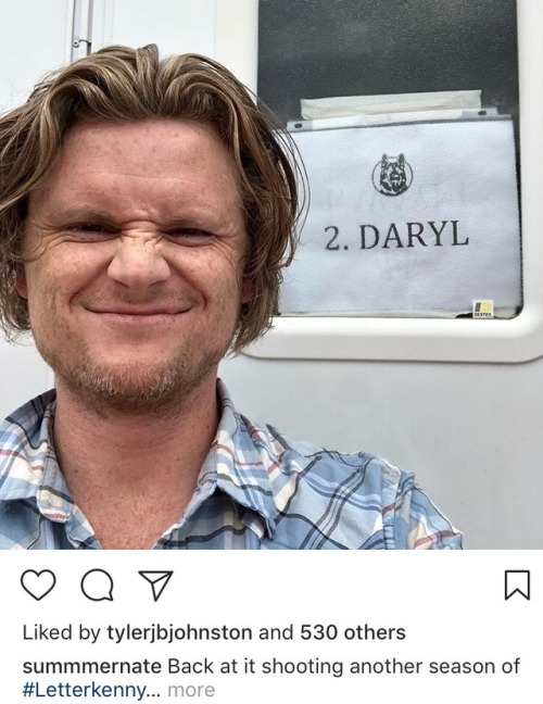 fuckyeahletterkenny:Those freckles tho