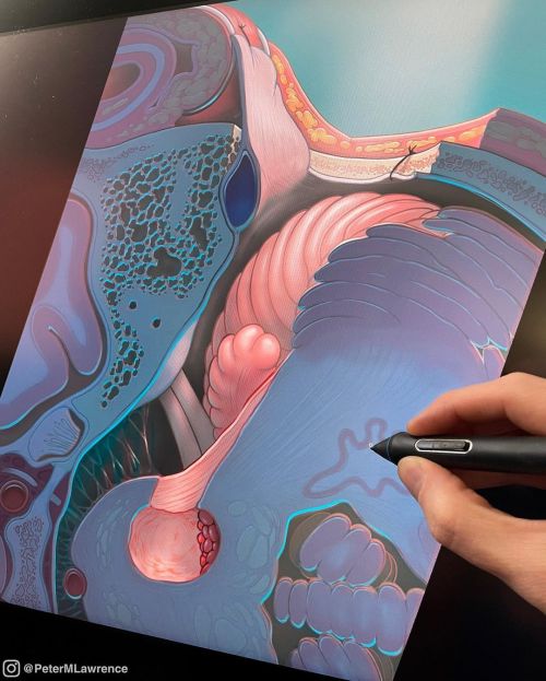 Touching up this illustration that was a collaboration with medical illustrator Mark Schornak. #medi