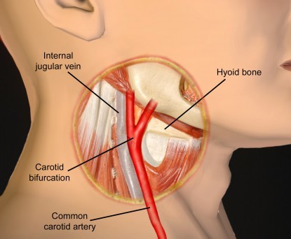 Porn photo Guide to choking during sex