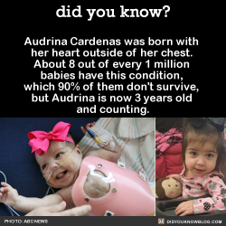 did-you-kno:  Audrina Cardenas was born with