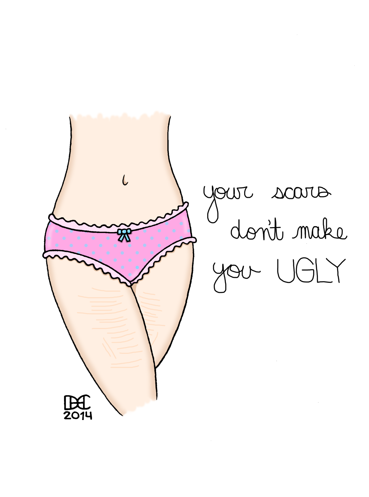 lost-little-switch:  I have a problem remembering this sometimes. To me my scars