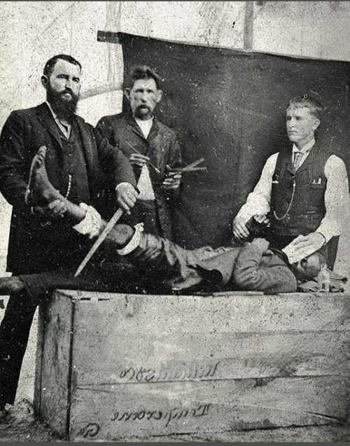 Surgery in 1855. adult photos
