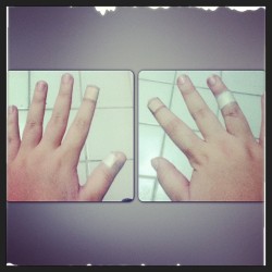 Se Eu Tenho Sorte? Imagina&Amp;Hellip;
