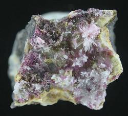 vugnasmineralblog:     Sainfeldite Guérinite &amp; PicropharmacoliteWilhelm Mine, Richelsdorf, Hesse, Germany                                                                                                 
