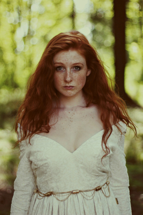 frecklesarebrilliant: Freckles are brilliant