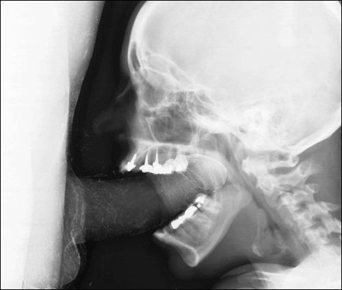 XXX thespitter:  blowjob on xray.  first ist photo