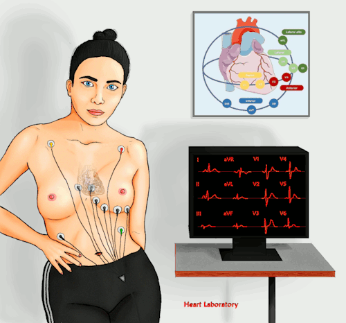 12-lead electrocardiogram is an extremely useful tool not just because it is able to show the cardia