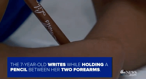 veryfemmeandantifascist:  blackademics:  micdotcom:  Virginia girl without hands