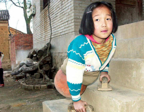 sixpenceee:sixpenceee:Qian Hongyan was just four when she lost both her legs. A speeding trucker lef