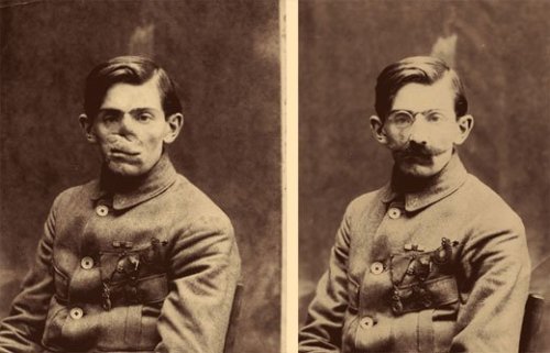 sedgewina:  Many soldiers came back from the trenches of WWI missing bits of their face. But 1920s society wasn’t the nicest place to look like a gnarled piece of meat, and facial surgery was barely beyond grafting your finger to your nose. The answer: