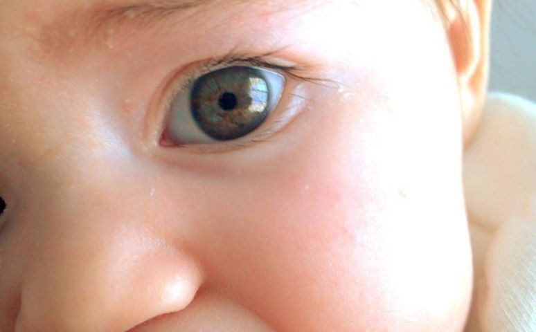 sixpenceee:  Some babies are often born with blue eyes that get darker over time.
