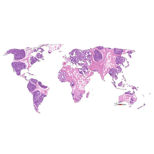 Mother Earth A biopsy of the mammary gland obtained during pregnancy.Let’s celebrate our plane