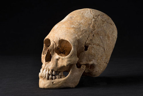 cultofweird:A 1,500-year-old elongated skull dating to the Merovingian period has been unearthed in 