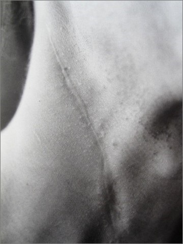 salvatorearato:Miyako Ishiuchi 