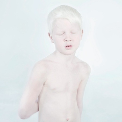 oau:Snow White by Sanne de Wilde “Like photographic material, people with albinism are light sensiti