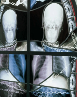 notbecauseofvictories:  X-Ray and Anatomical Stained Glass Windows by Wim Delvoye 