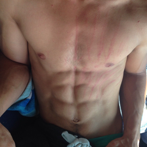 athleticbrutality:  once the rut starts it’s gonna finish no matter what   wear those marks with pride